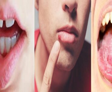 Cheapest Most Important Miracle Vitamin To Repair Tendons & Ligaments in this super 5 Healthy Foods