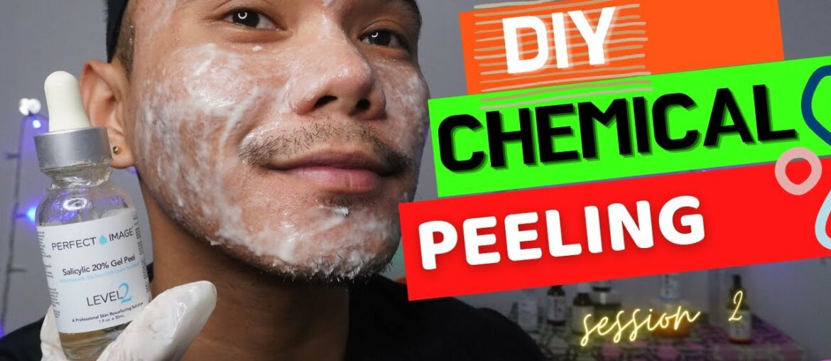 DIY Chemical Peeling At Home | Session 2