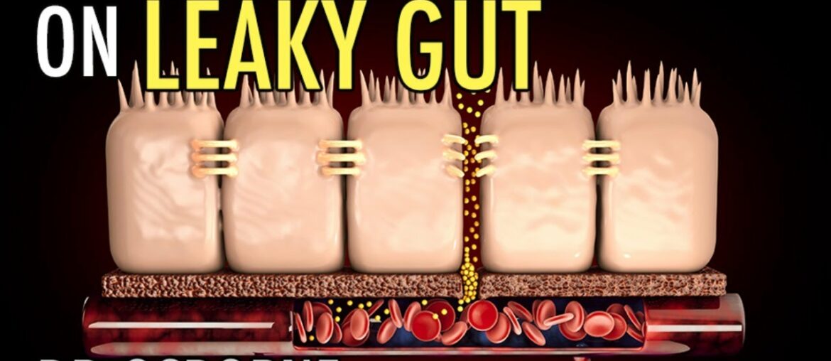 Part 2 - The Ultimate Crash Course on Leaky Gut - Supplements