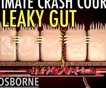 Part 2 - The Ultimate Crash Course on Leaky Gut - Supplements