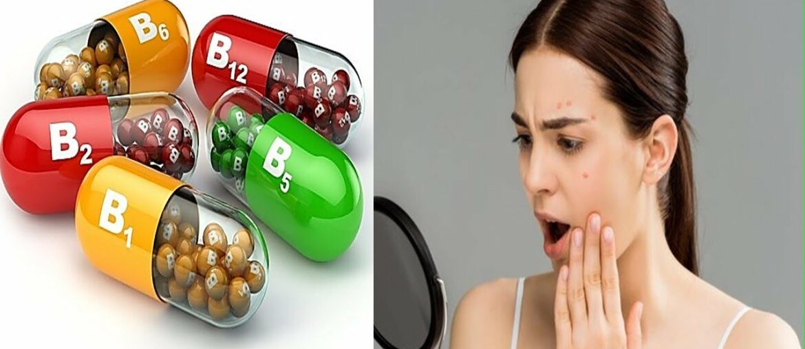 Vitamin Deficiencies That Show Up in Your Face