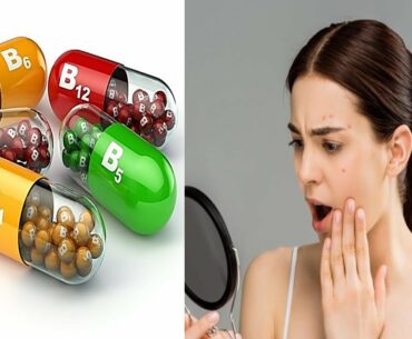 Vitamin Deficiencies That Show Up in Your Face