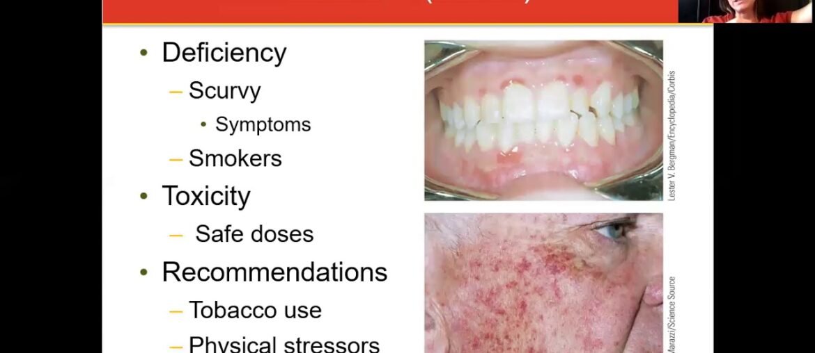 Week 7 Lecture Vitamin C and B Vitamins