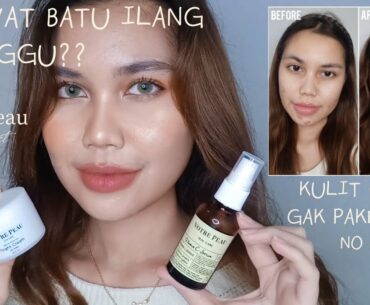 [REVIEW] Votre Peau: Vitamin C Serum & Night Cream | Acne Treatment + Anti Aging skincare