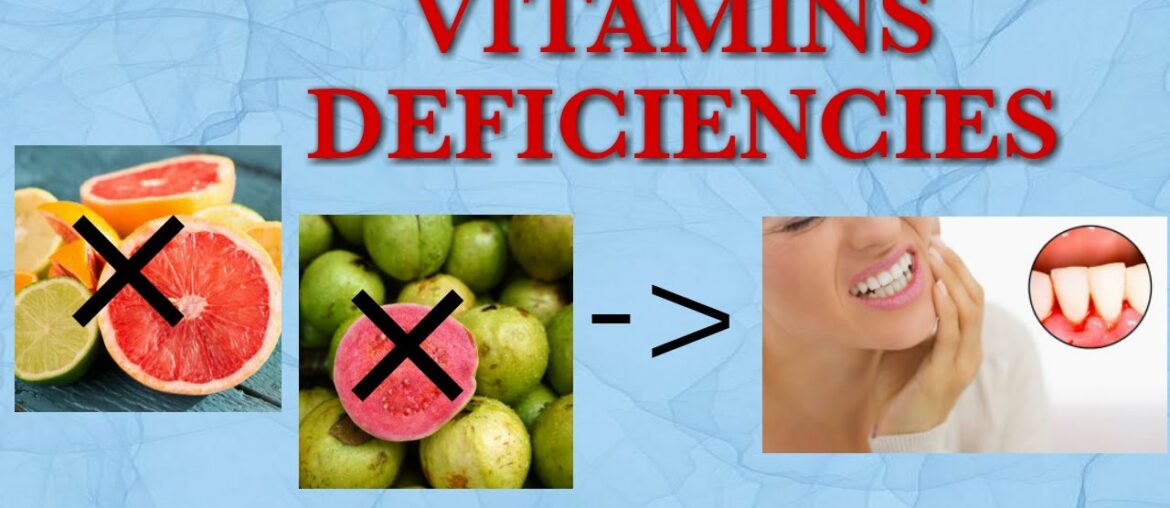 || NUTRIENTS || VITAMIN DEFICIENCIES ||
