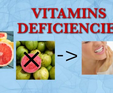 || NUTRIENTS || VITAMIN DEFICIENCIES ||