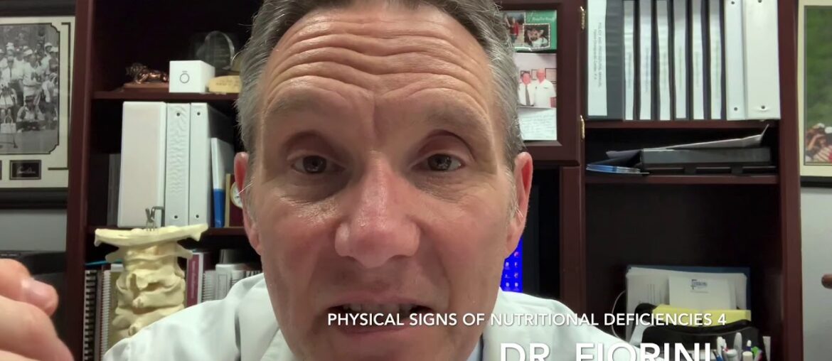 Physical signs of nutritional deficiencies 4!