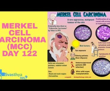 Merkel Cell Carcinoma  I Day-122