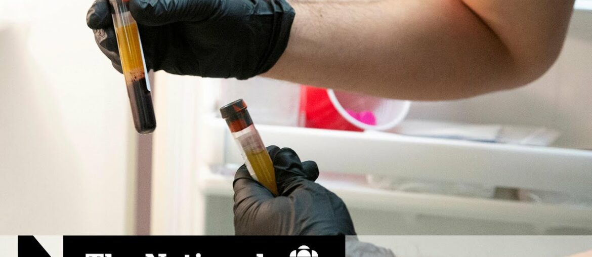 COVID-19 antibodies may disappear quickly, new study finds