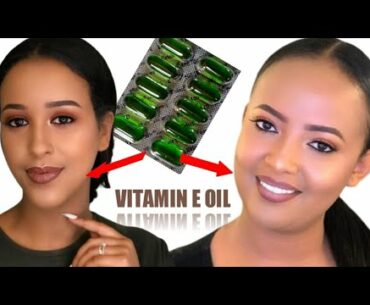Haala itti Fayyadama Vitamin E . Fuula Keenya Lallaaffisuuf.How To Use Vitamin E For skin Moisture