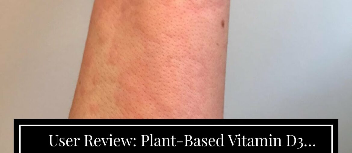 User Review: Plant-Based Vitamin D3 Immune Support with Vegan K2 Complex in a Vegetarian Softge...