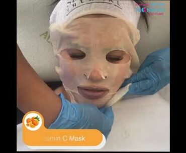 Vitamin C Facial
