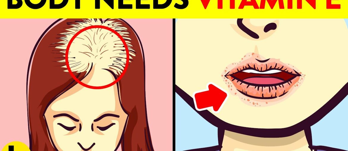 9 Warning Signs Your Body Is Missing Vitamin E