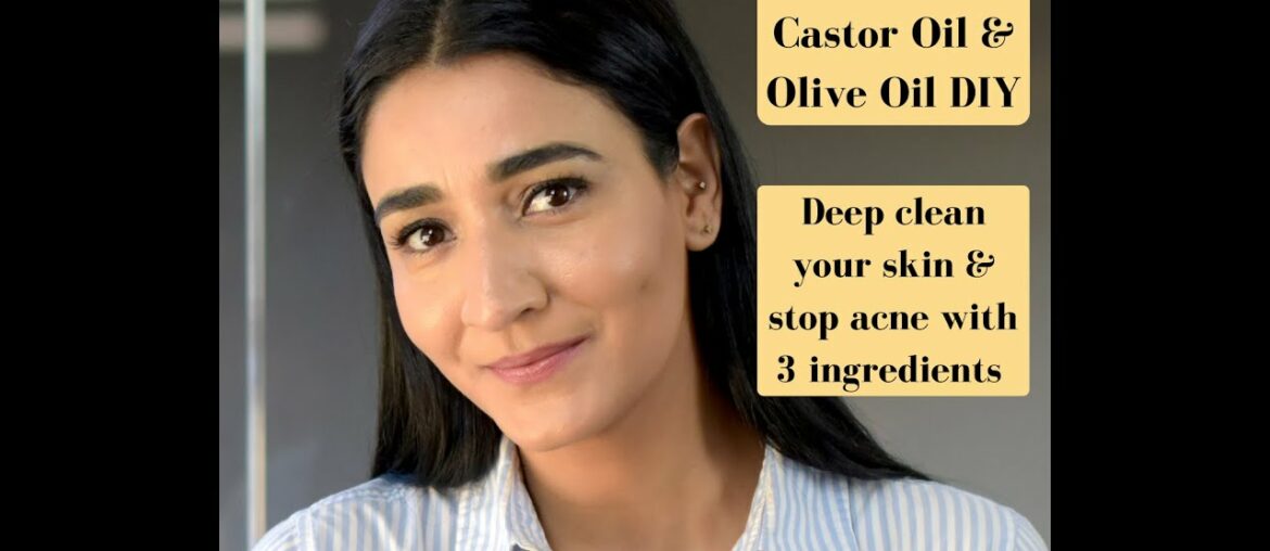 Vitamin E, Castor Oil & Olive Oil DIY Home Remedy to Deep Clean Pores & Reduce Acne