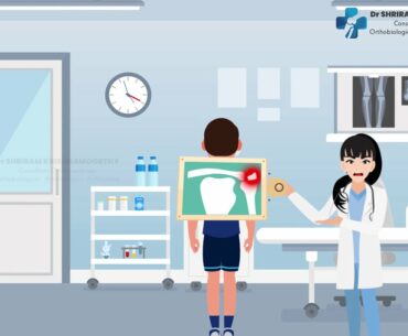 Everything you know about shoulder dislocation!