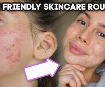 MY ACNE SKINCARE ROUTINE || EVENING ROUTINE, SIMPLE Skincare