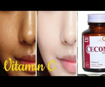 Dr Muskan| Whitening and Glowing Skin Secret| Vitamin C| My Review| Cecon Tablet Uses|