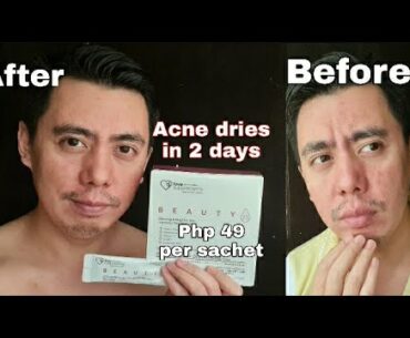 2 DAYS IMPRESSION | LOVE SUPPLEMENTS DRINK WITH GLUTATHIONE, VITAMIN C, COENZYME Q10 & COLLAGEN