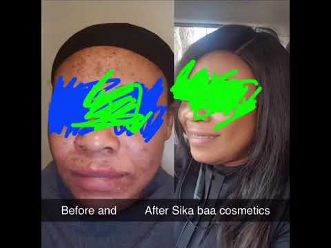 Skincare , glutathione, vitamin c etc