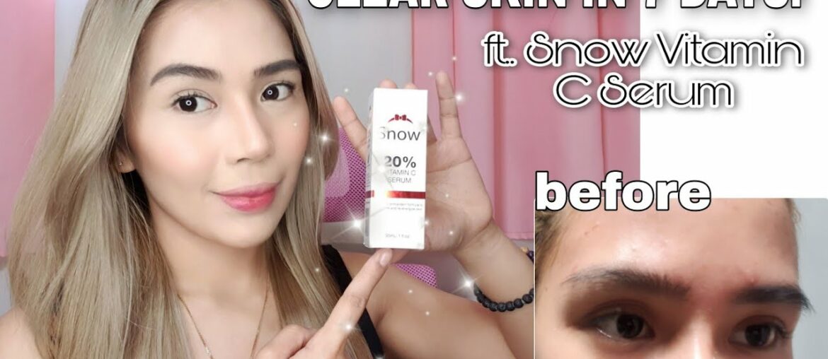 HOW TO LIGHTEN DARK SPOTS | BEST LOCAL SERUM I'VE TRIED FT. SNOW 20% VITAMIN C SERUM REVIEW