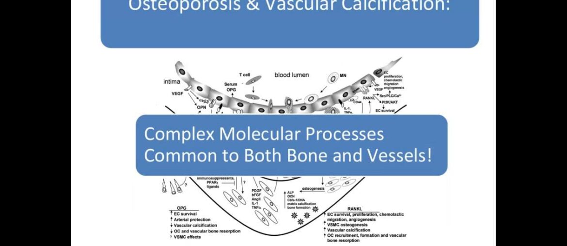 Dr. Sarah Booth - Vitamin K & Vitamin D