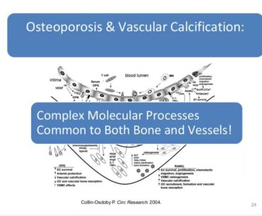 Dr. Sarah Booth - Vitamin K & Vitamin D