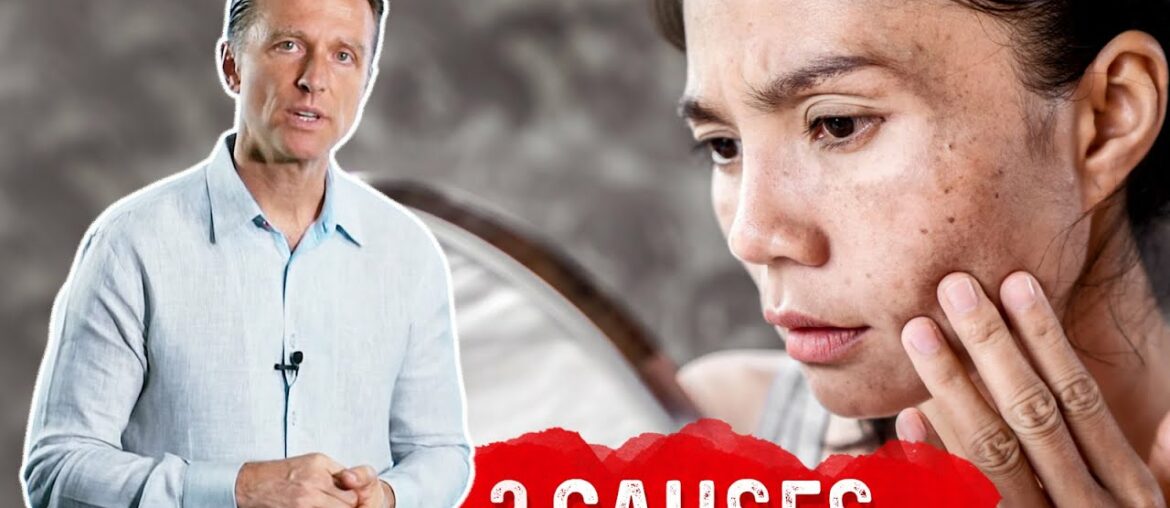 Darkened Skin Spots: 3 Causes