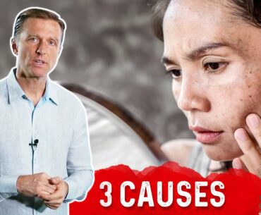 Darkened Skin Spots: 3 Causes