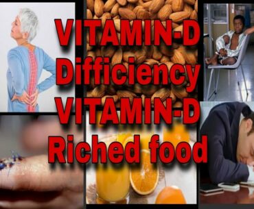 VITAMIN-D dificiency problem /Foods Rich in VITAMIN -D