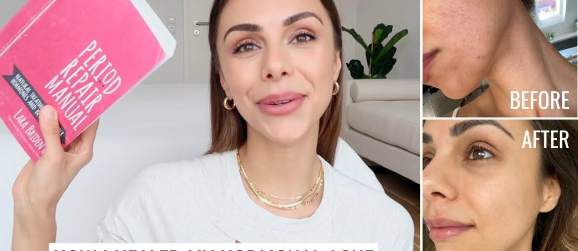 How I Healed My Hormonal Acne | Diet, Supplements & Skincare | Annie Jaffrey