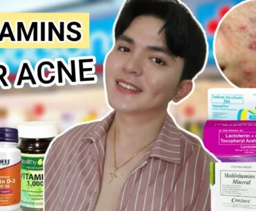 MURANG VITAMINS PARA IWAS ACNE OR TAGHIYAWAT (ZINC, LACTEZIN, CONZACE)