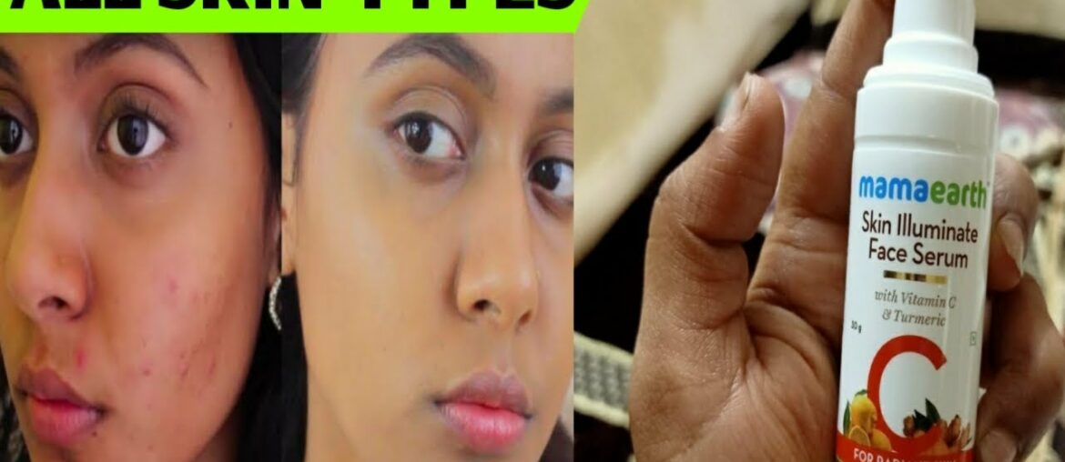 Mamaearth Vitamin C Serum Review || Best For Hyperpigmentation/Wrinkles/Darkspots