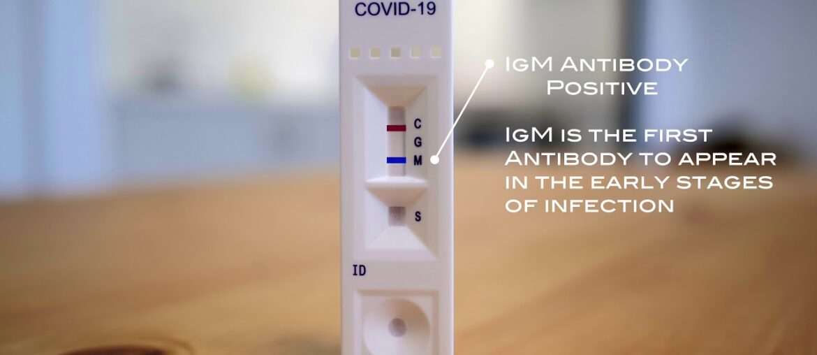 Fortress Fast Covid 19 Home Test Example