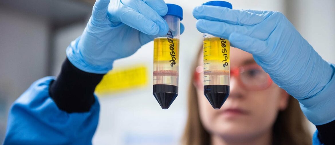 Oxford Covid-19 vaccine is 'vaccine for the world', says director of vaccine group