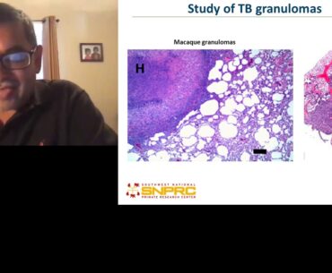 BD FACSMatters Ask the Expert: Understanding COVID-19 and Immune Responses