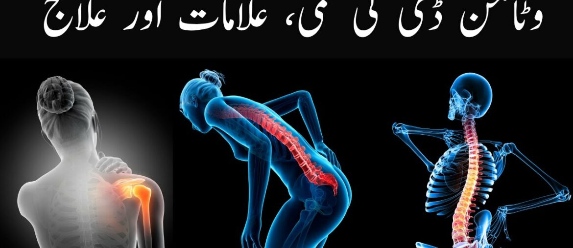 Vitamin D deficiency symptoms and prevention| Vitamin D ki kami ki alamaat aur ilaj