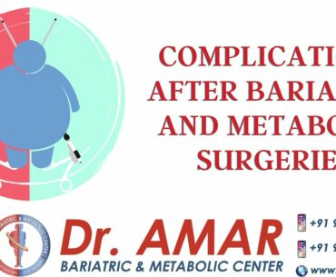 COMPLICATIONS AFTER BARIATRIC AND METABOLIC SURGERIES - News Today - Dr. V. AMAR - +91 96766 75646