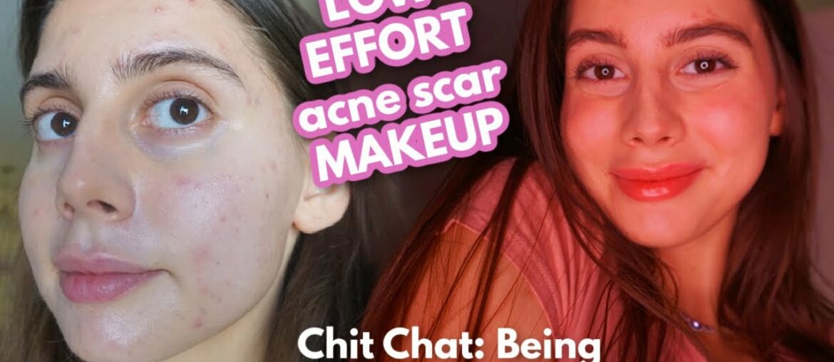 LOW EFFORT ACNE SCAR COVERAGE MAKEUP || Chit Chat: being hard on yourself, low self esteem