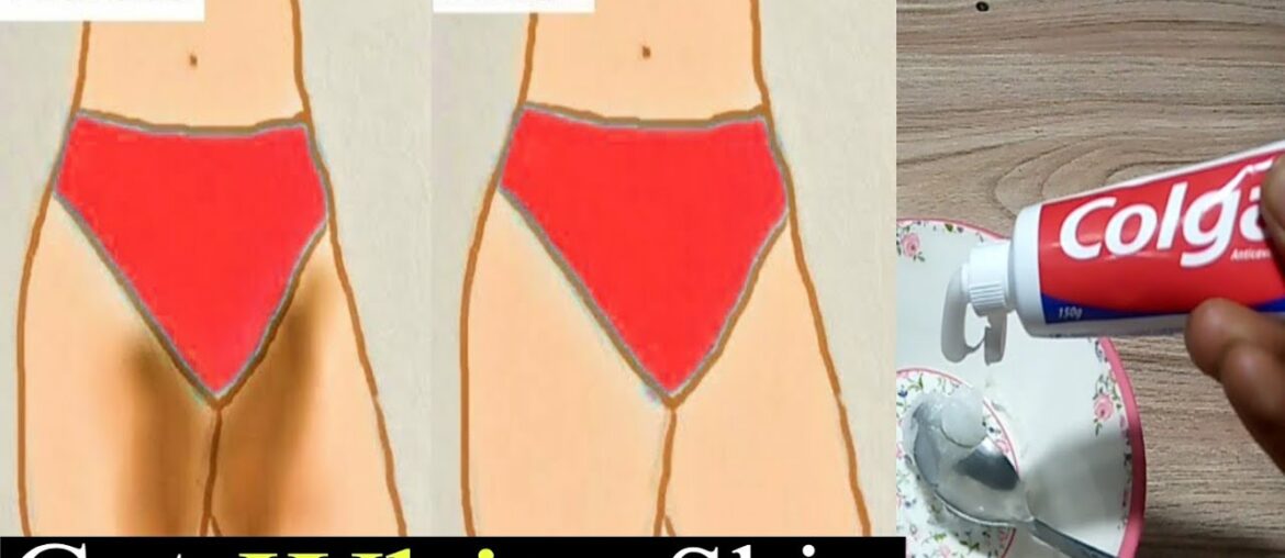 Use This Vitamin A&D Capsule And Get Good Result