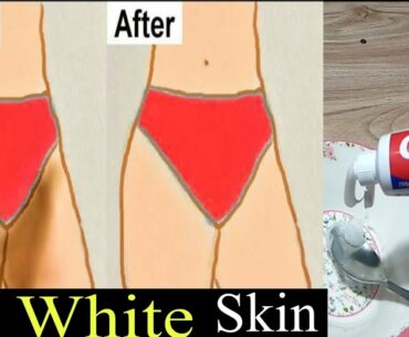 Use This Vitamin A&D Capsule And Get Good Result