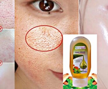 Treasure herbs Vitamin C Face wash | Anti Aging, Acne & pimples, Marks & Scars and Skin whitening?