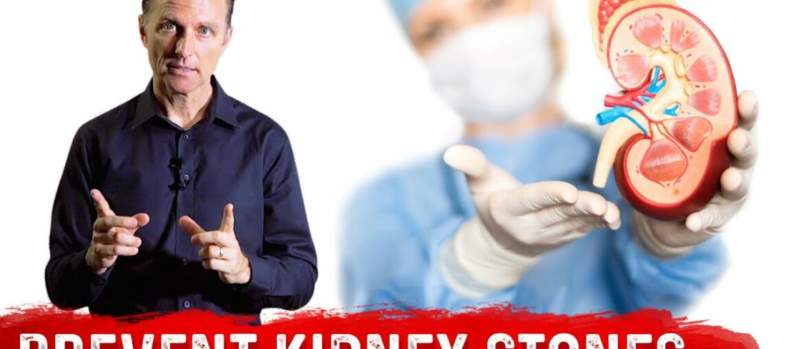 Use Vitamin A for Kidney Stones