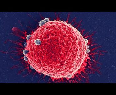 Vitamin D supplements may reduce the risk of developing advanced cancer