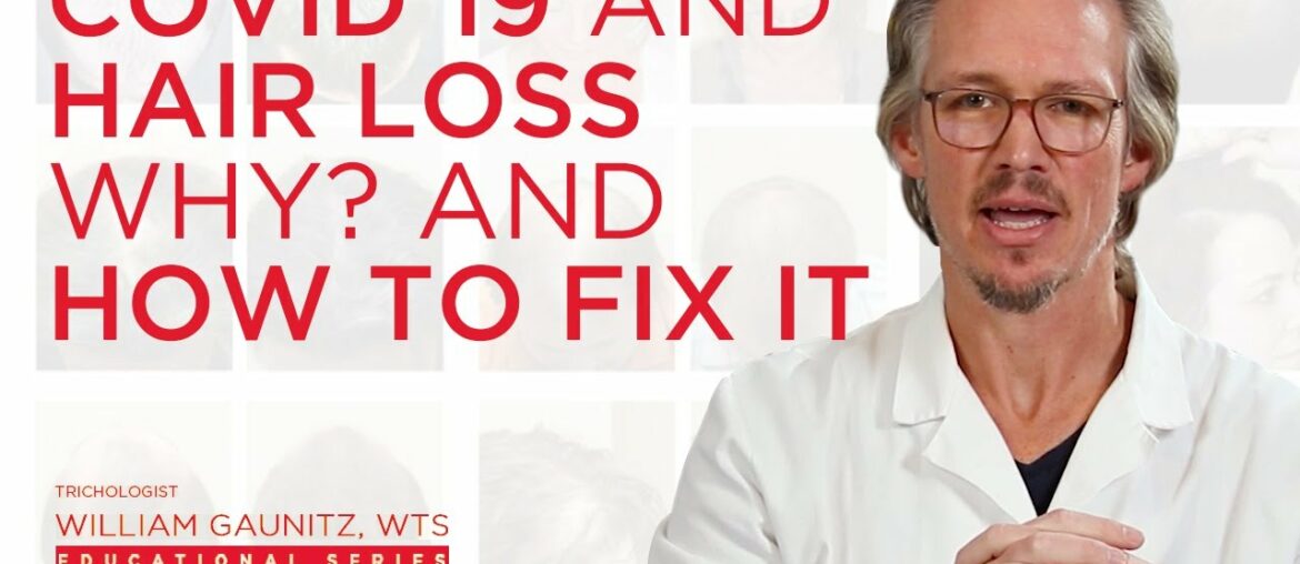 What is Covid 19 Hair Loss? Coronavirus hair loss treatment for Men and Women from Telogen Effluvium