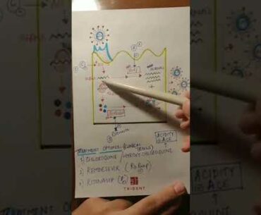 PATHOPHYSIOLOGY OF COVID 19
