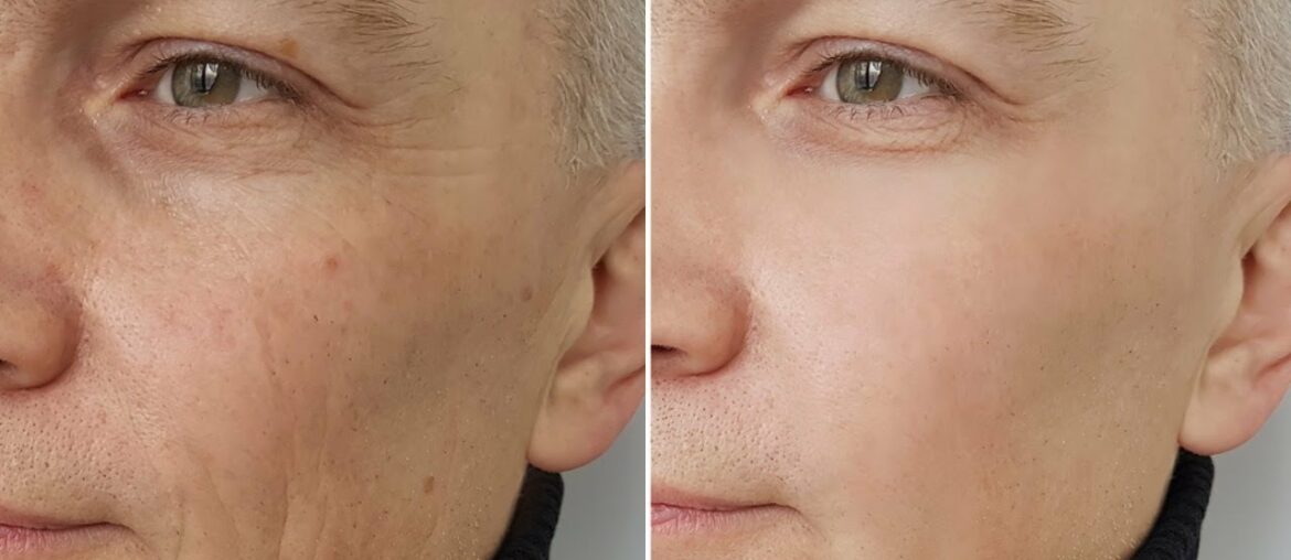 How sleep affects your BEAUTY - Start from today!