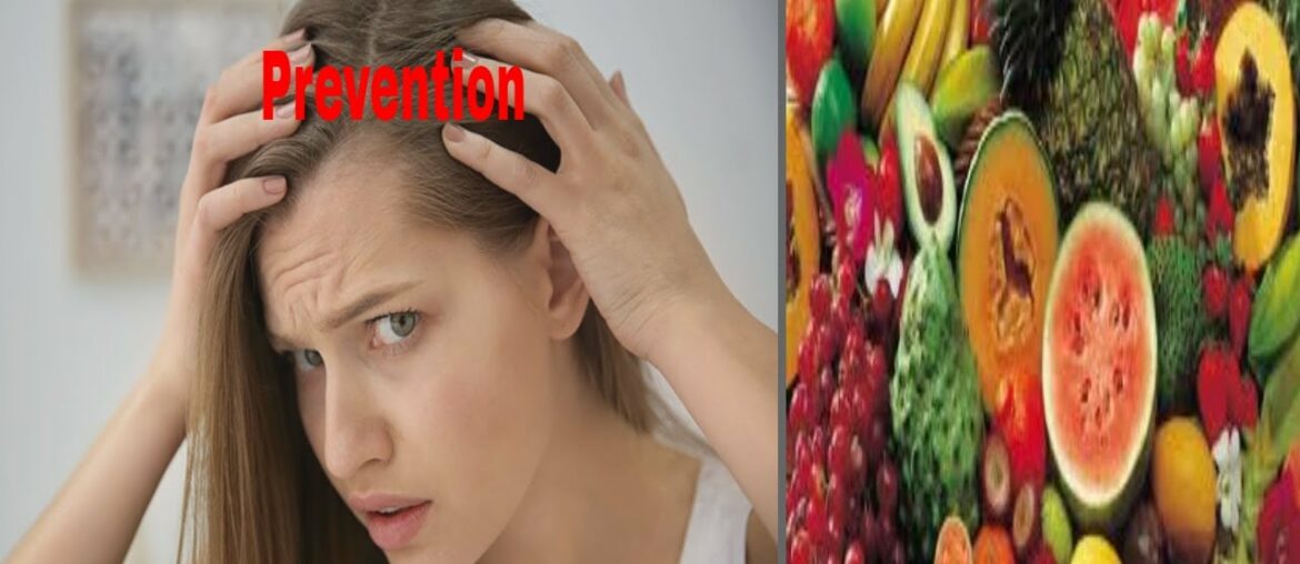 Vitamins For Female Hair Loss Prevention.