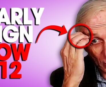 Vegans Should Not Ignore This Early Sign Of B12 Deficiency