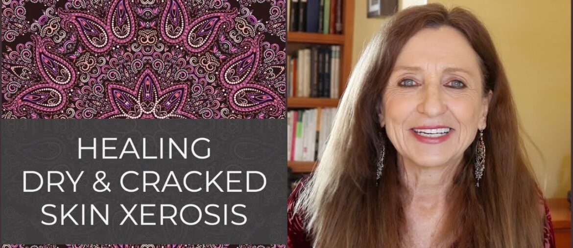 Top Natural Remedies for Dry Skin - Dec 1, 2020 - Medica Nova Wellness Studio