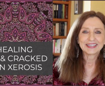 Top Natural Remedies for Dry Skin - Dec 1, 2020 - Medica Nova Wellness Studio